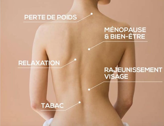 La luxopuncture et la naturopathie